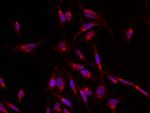 GLUT4 Polyclonal Antibody