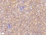 ADAMTS4 Polyclonal Antibody