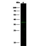 BST-1 Polyclonal Antibody