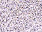 C1QB Polyclonal Antibody