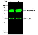 C1QBP Antibody in Immunoprecipitation (IP)