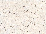 Carbonic Anhydrase II Antibody in Immunohistochemistry (Paraffin) (IHC (P))