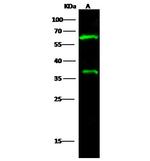 Carbonic Anhydrase VIII Antibody in Western Blot (WB)