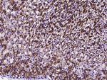 Carbonic Anhydrase IX Antibody in Immunohistochemistry (Paraffin) (IHC (P))