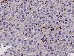 AIM Polyclonal Antibody