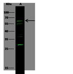 CD96 Antibody in Western Blot (WB)