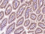CDH17 Polyclonal Antibody