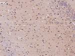 CNDP1 Polyclonal Antibody