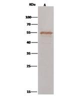 CNDP2 Antibody in Immunoprecipitation (IP)