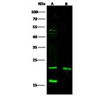CRP Polyclonal Antibody