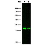 Cathepsin A Polyclonal Antibody