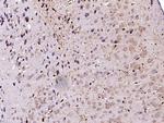 DOPA Decarboxylase Polyclonal Antibody