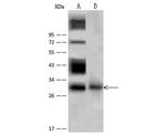 Neutrophil elastase Antibody in Western Blot (WB)
