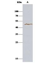 FCRL1 Antibody in Immunoprecipitation (IP)