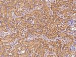 FGFR3 Polyclonal Antibody