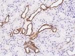 GGT1 Polyclonal Antibody