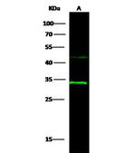 15-PGDH Polyclonal Antibody