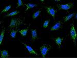 IFITM1 Antibody in Immunocytochemistry (ICC/IF)