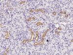 IGFBP2 Polyclonal Antibody