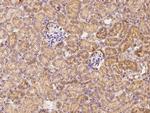 IL20RA Polyclonal Antibody