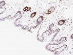 IL20RA Antibody in Immunohistochemistry (Paraffin) (IHC (P))