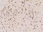 LDLR Polyclonal Antibody
