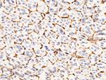 CD146 Polyclonal Antibody