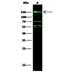 CD146 Antibody in Western Blot (WB)