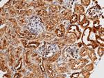 METAP2 Polyclonal Antibody