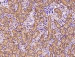 MSMB Polyclonal Antibody