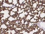 Podoplanin Antibody in Immunohistochemistry (Paraffin) (IHC (P))