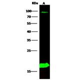 PPBP Polyclonal Antibody