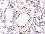 EPCR Polyclonal Antibody