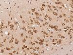 Pleiotrophin Antibody in Immunohistochemistry (Paraffin) (IHC (P))