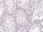 SALL4 Polyclonal Antibody