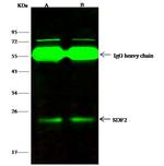 SDF2 Antibody in Immunoprecipitation (IP)