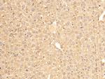 SERPINA7 Polyclonal Antibody
