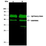 SERPINB8 Antibody in Immunoprecipitation (IP)