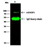 Thimet Oligopeptidase Antibody in Immunoprecipitation (IP)
