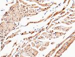 UCHL3 Polyclonal Antibody