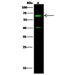 CBX2 Polyclonal Antibody