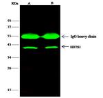EIF2S1 Antibody in Immunoprecipitation (IP)