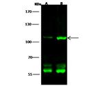 GluR2 Polyclonal Antibody