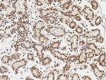 JMJD5 Polyclonal Antibody