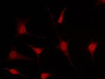 MSI1 Polyclonal Antibody