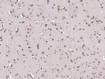MSI1 Antibody in Immunohistochemistry (Paraffin) (IHC (P))