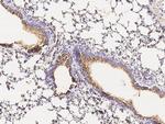 MUC1 Antibody in Immunohistochemistry (Paraffin) (IHC (P))