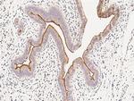 MUC1 Antibody in Immunohistochemistry (Paraffin) (IHC (P))