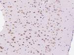EBP1 Antibody in Immunohistochemistry (Paraffin) (IHC (P))