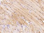 PIK3CG Polyclonal Antibody